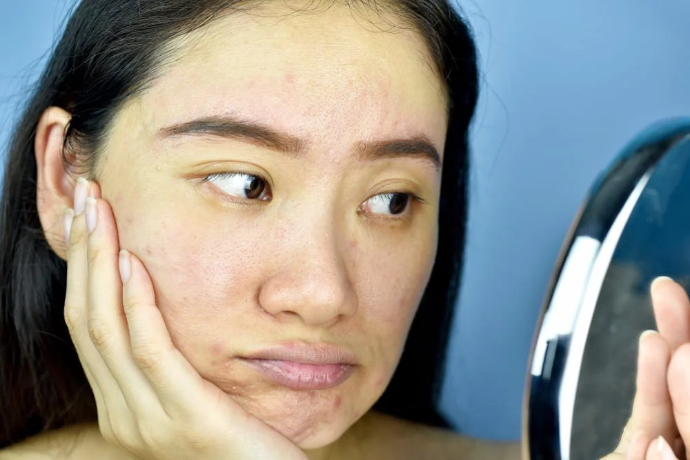 Kulit Kusam Bikin Nggak Pede? Ini Cara Simpel Balikin Glowing Alami!