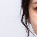 Flek Hitam Bikin Risih? Coba Trik Ini, Kulit Glowing Kembali Lagi!