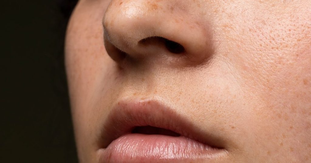 Bye Pori-Pori Besar! Ini 5 Bahan Skincare Ampuh Bikin Kulit Mulus Maksimal
