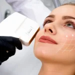 Manfaat HIFU Treatment: Solusi Non-Bedah untuk Kulit Wajah Lebih Kencang dan Awet Muda