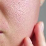 Rahasia Kulit Halus Terungkap: Skincare dengan Bahan Aktif Pengecil Pori Ini Wajib Kamu Coba!
