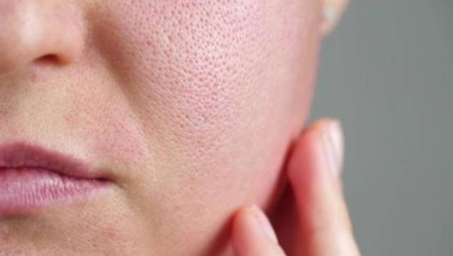 Rahasia Kulit Halus Terungkap: Skincare dengan Bahan Aktif Pengecil Pori Ini Wajib Kamu Coba!