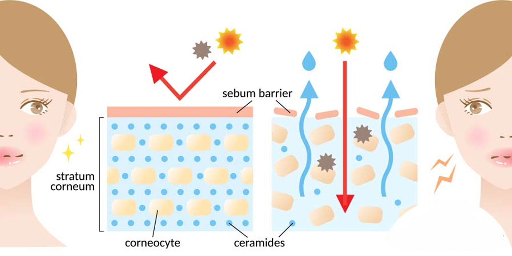 Ceramide: Penjaga Kulit yang Diam-Diam Bekerja Keras