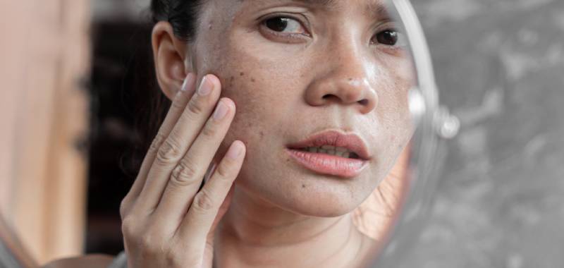 Kurang Tidur, Tambah Kusam! Ini Dampak Pola Tidur Buruk untuk Kecantikan