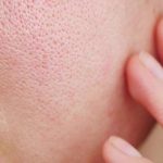 Pori-pori Kecil, Kulit Mulus: Cara Ampuh Mengecilkan Pori Secara Alami!