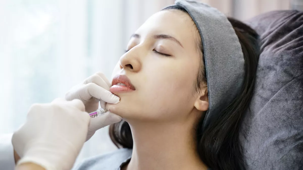 Treatment Filler: Apa yang Perlu Kamu Tahu Sebelum Memutuskan?