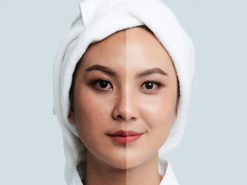 Warna Kulit Wajah Belang? Ini 5 Tips Ampuh untuk Membuatnya Lebih Merata dan Cerah