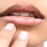 Atasi Bibir Kering Secara Alami: Cara Praktis Bikin Bibir Lembap dan Sehat Lagi!