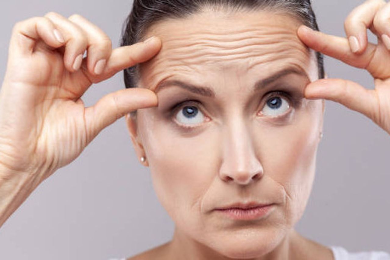 Benarkah Stres Mempercepat Munculnya Keriput? Simak Penjelasan Medisnya di Sini