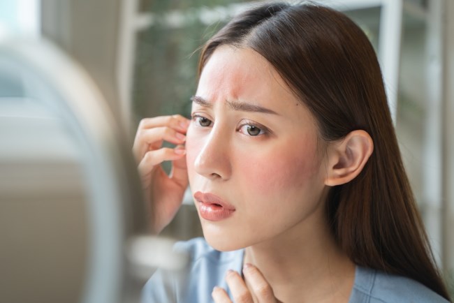 Kulit Kering dan Mengelupas? Atasi dengan 5 Cara Pengobatan Ampuh Ini!