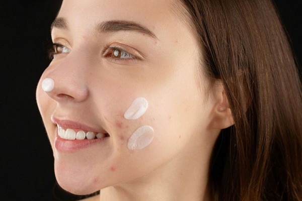 Tretinoin Bikin Kulit Glowing, Tapi Apa Aman? Ini Efek Samping yang Perlu Diwaspadai