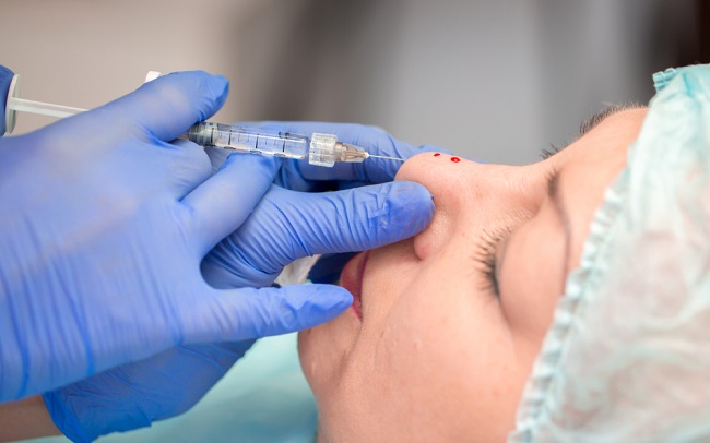 Yang Perlu Anda Tahu Sebelum Memilih Filler Hidung