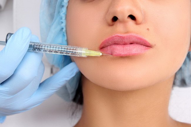 Ingin Wajah Awet Muda? Ini 6 Jenis Suntik Filler yang Perlu Kamu Tahu